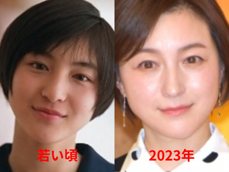 広末涼子の首のシワが劣化