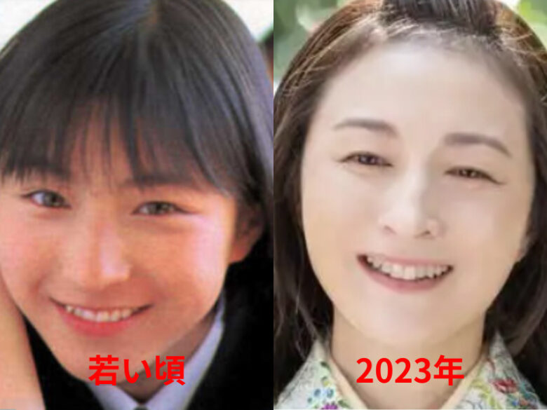 広末涼子の首のシワが劣化